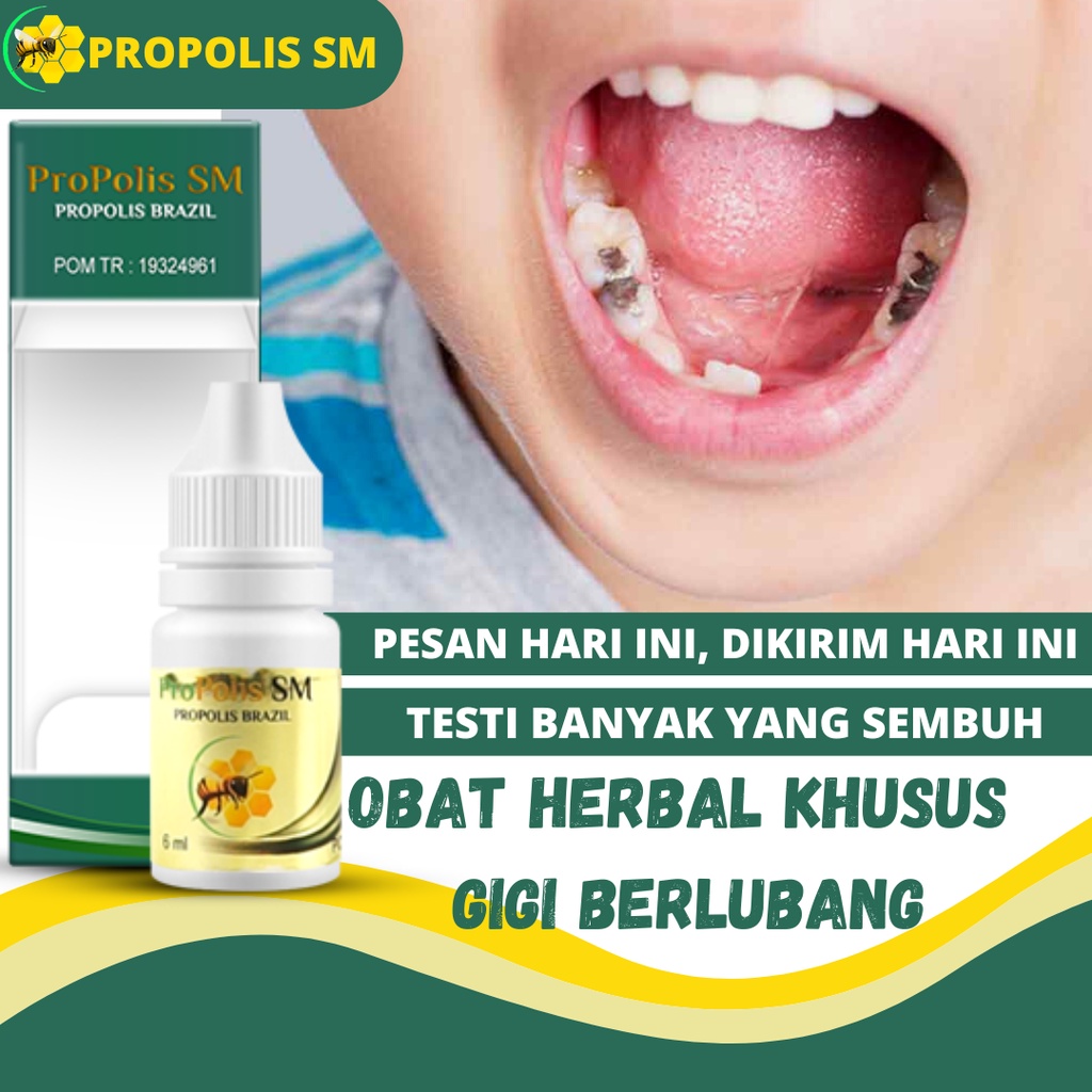 Herbal penghilang sakit gigi akibat gusi bengkak
