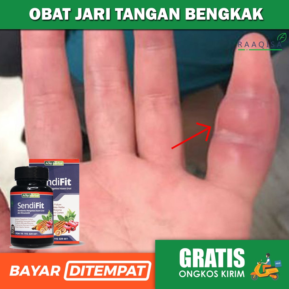 Jual Obat Jari Tangan Bengkak Terkilir Keseleo Patah Tulang Jari Sendifit Original Shopee 