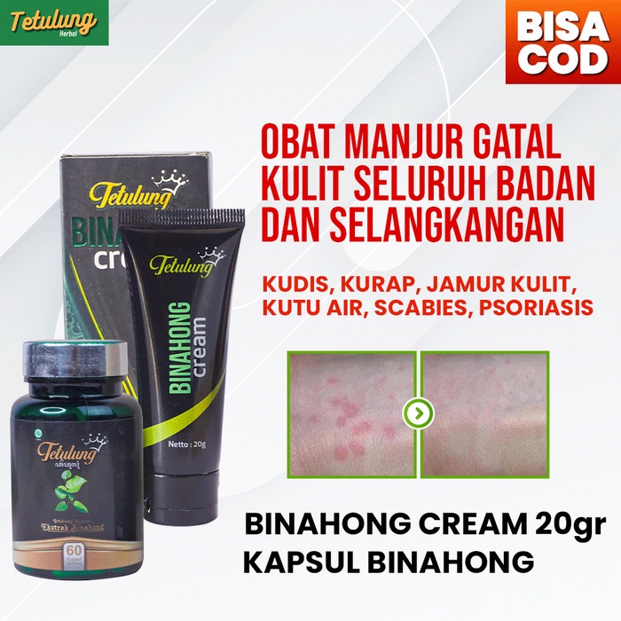 Jual Binahong Cream + Kapsul Obat Gatal Kulit Biduran / Kurap Paling