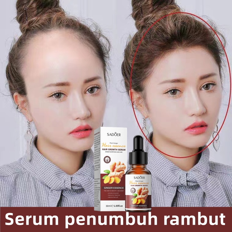 Jual Penumbuh rambut Serum penumbuh rambut Penumbuh rambut botak Minyak ...