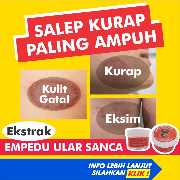 Jual Salep Obat Kurap Paling Ampuh Gatal Panu Jerawat Jamur Kulit Kutu ...