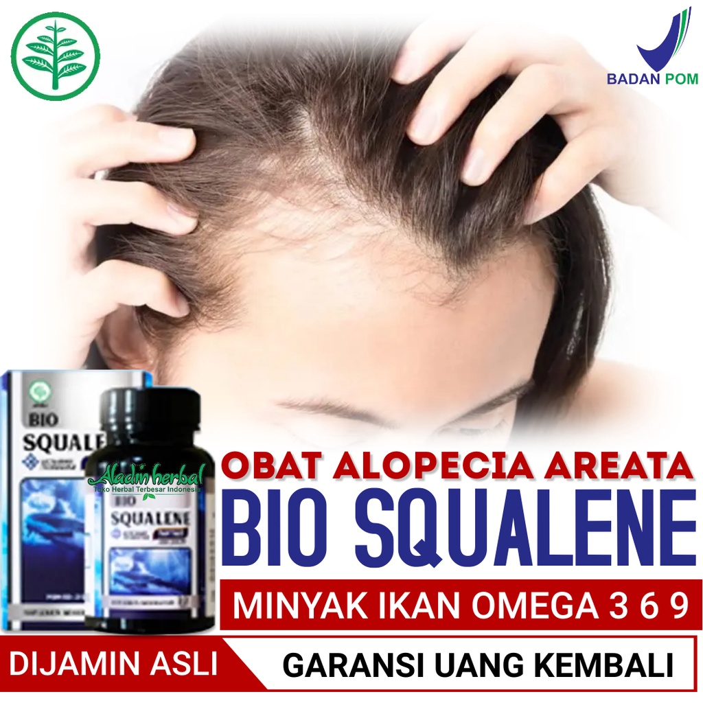 Jual Obat Alopecia Areata Kebotakan Rambut Pada Kepala - Obat Penumbuh