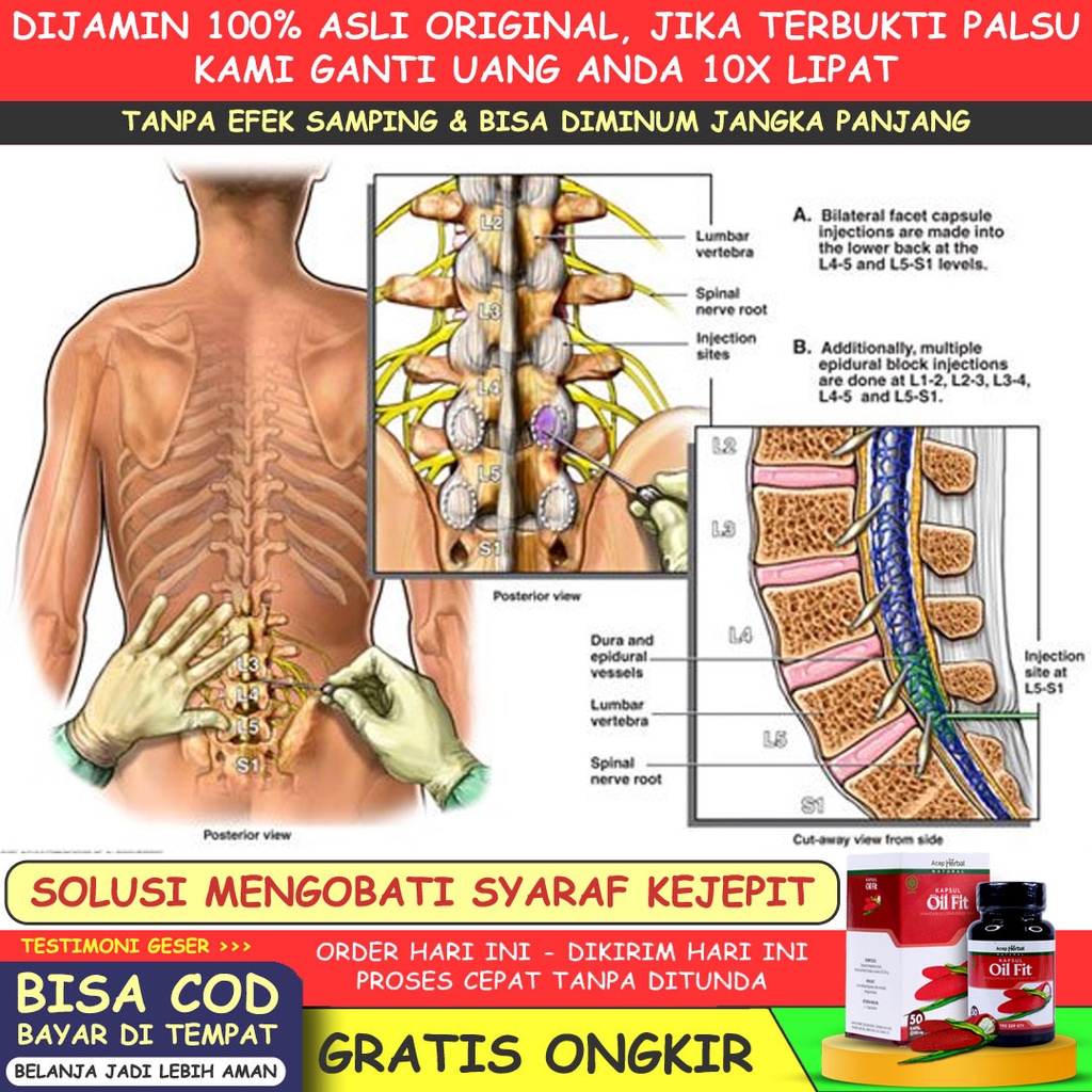 Jual Obat Sakit Urat Syaraf Kejepit Pinggang Sampai Kaki Bokong Saraf