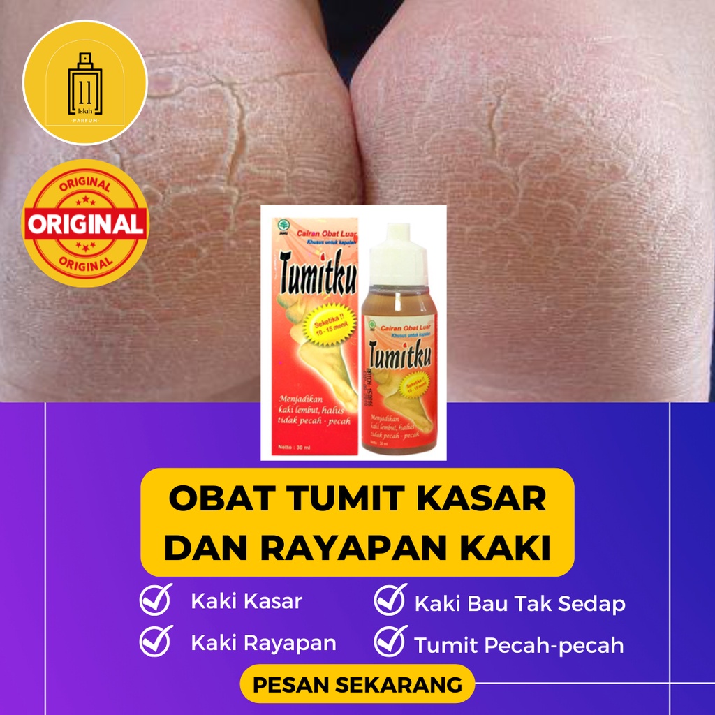 Jual Tumitku Obat Kaki Pecah Original Bpom Solusi Kaki Pecah Pecah Dan Kapalan Ukuran 30 Ml 4073