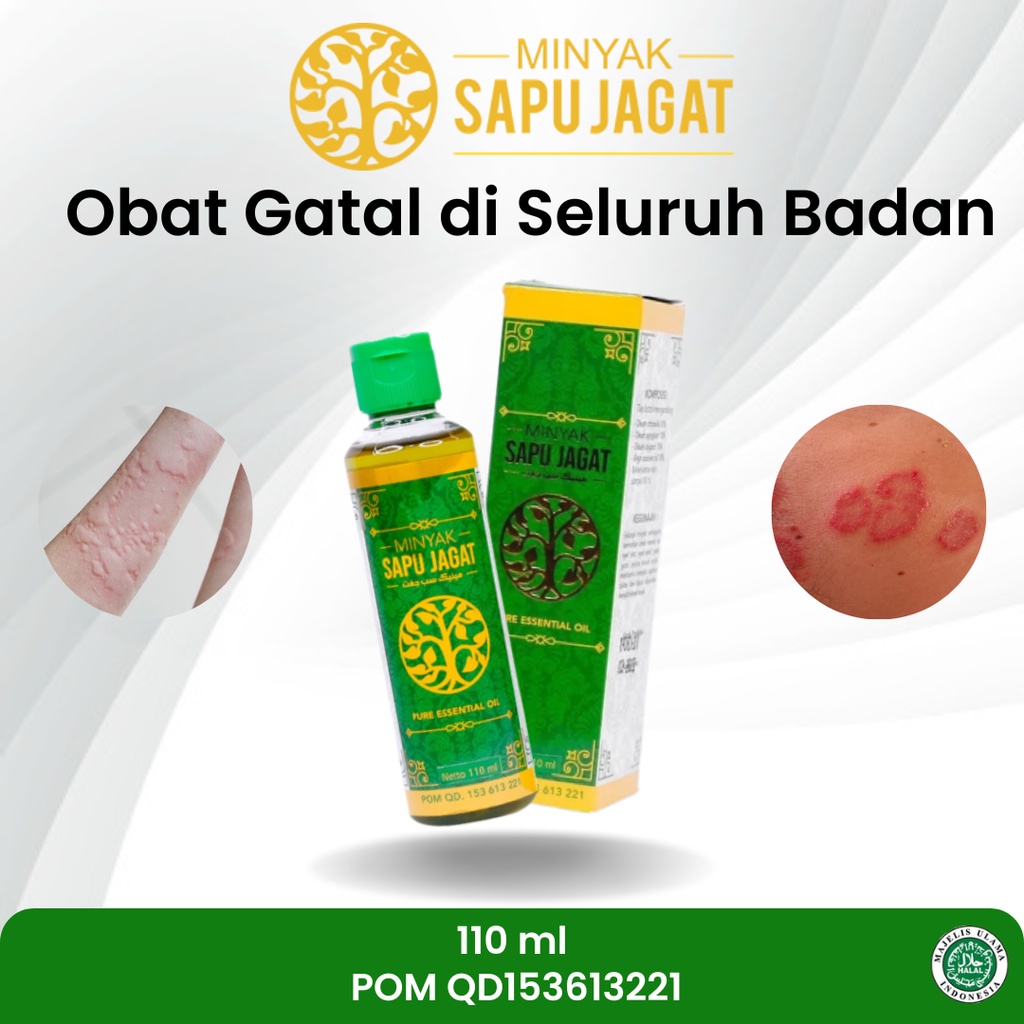 Jual Sapnu Herbal Obat Gatal Gatal Di Seluruh Badan Gatal Alergi