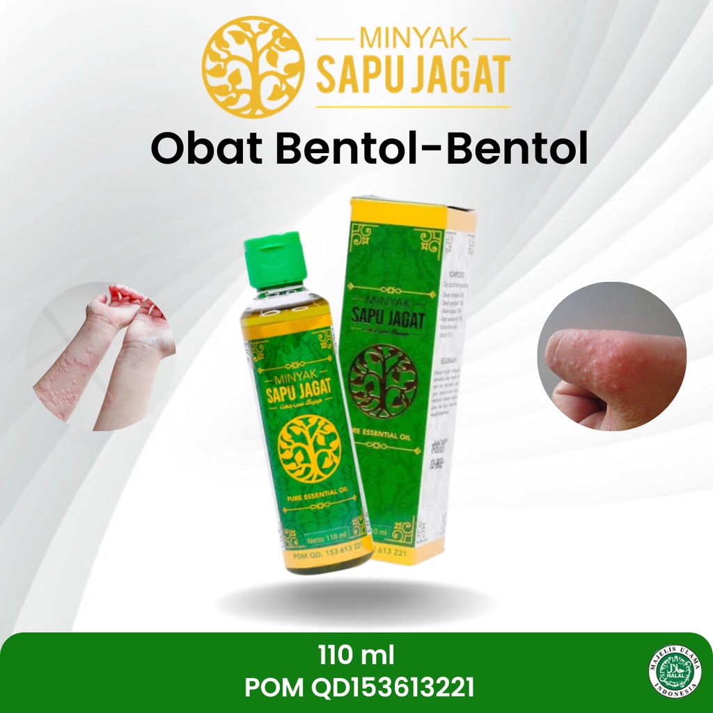 Jual Sapnu Herbal - Obat Biduran, Gatal Gatal, Biduran Menahun ...