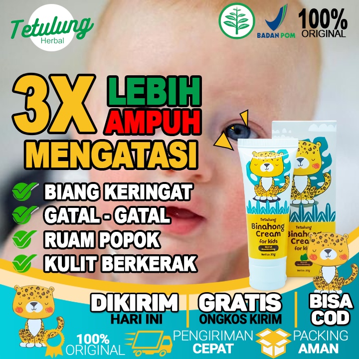 Jual Salep Herbal Obat Iritasi Parah Baby Krim Anti Gatal Ruang Anak