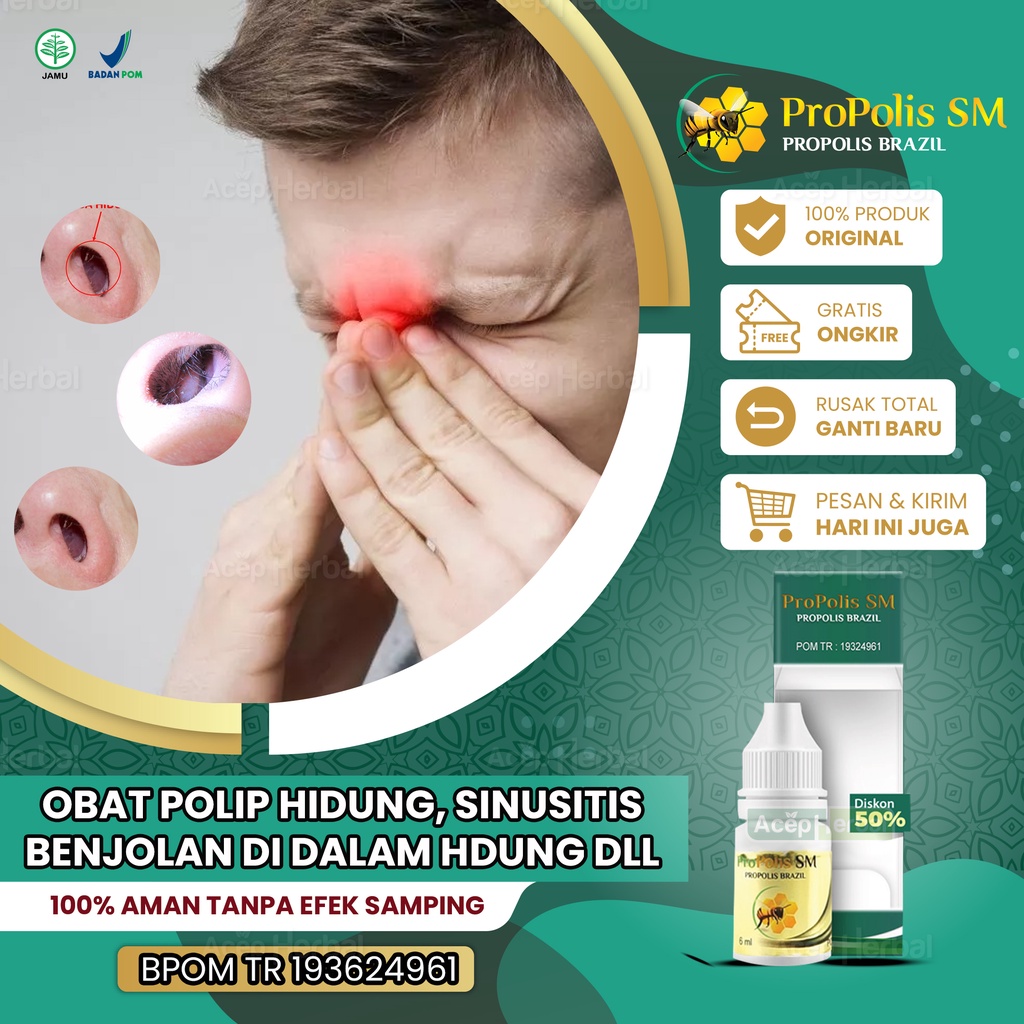 Jual Obat Polip Hidung Sinusitis Benjolan Di Dalam Hidung Pilek Menahun ...