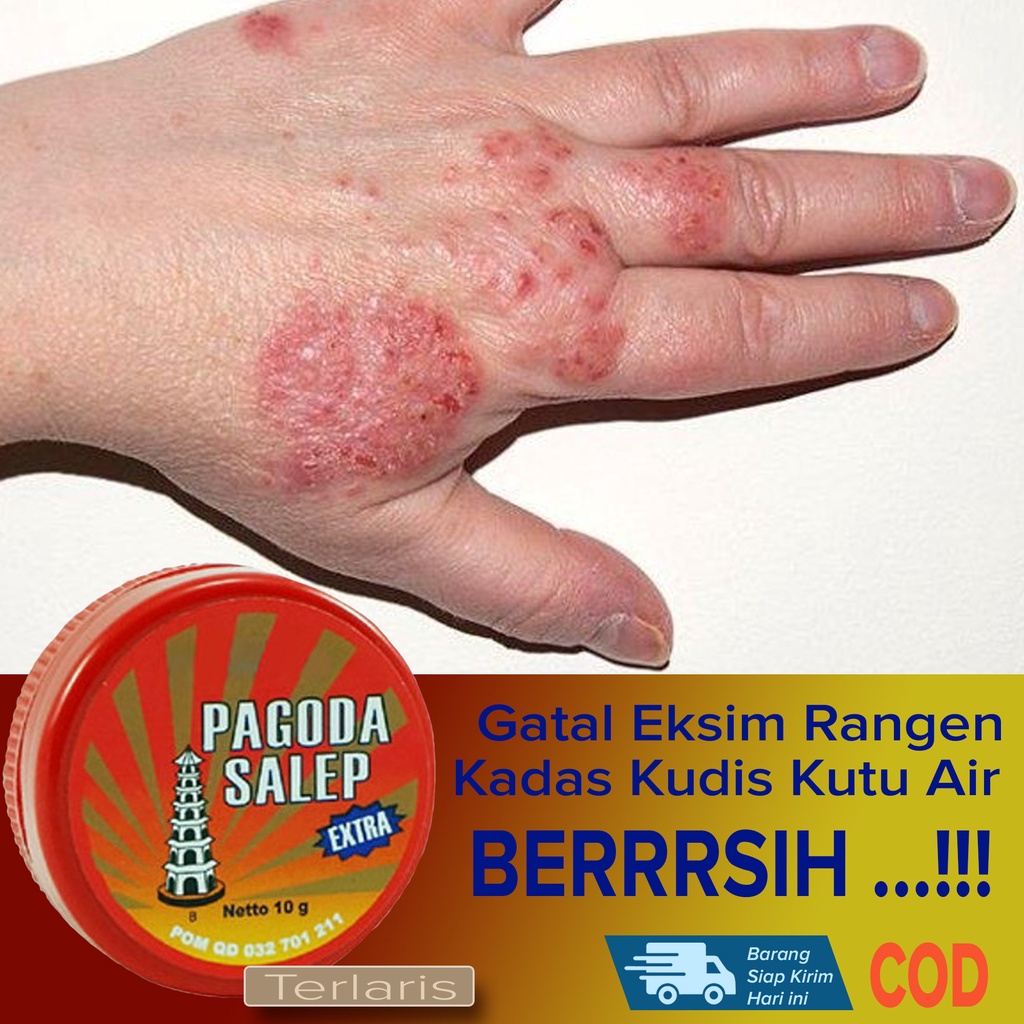 Jual Salep Obat Gatal Eksim Kurap Kadas Kudis Gatal Jamur Lainnya AMPUH ...