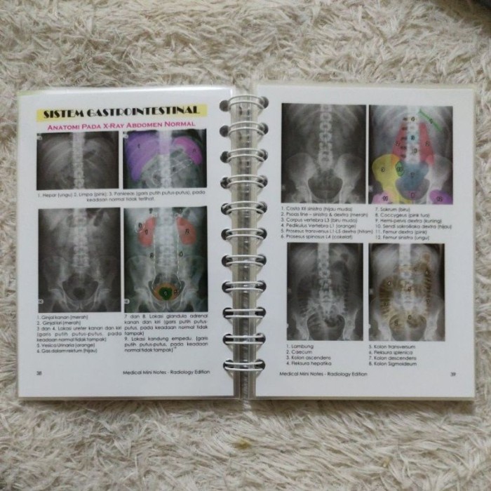 Jual Buku Kedokteran Medical Mini Notes Radiology Mmn Buku Saku ...