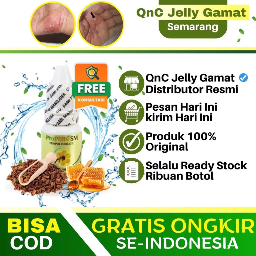 Jual Obat Scabies Di Apotik, Scabies Manusia, Gatel Gatal Alergi, Obat ...