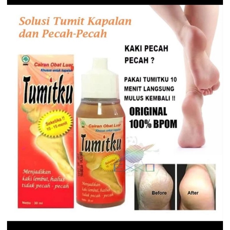 Jual Tumitku Solusi Tumit Pecah dan Kapalan 30 ML 100% Original ...