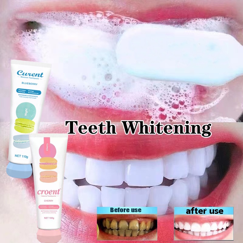 Jual Pasta Gigi Pemutih Gigi Pencegah Gigi Berlubang Toothpaste Pasta