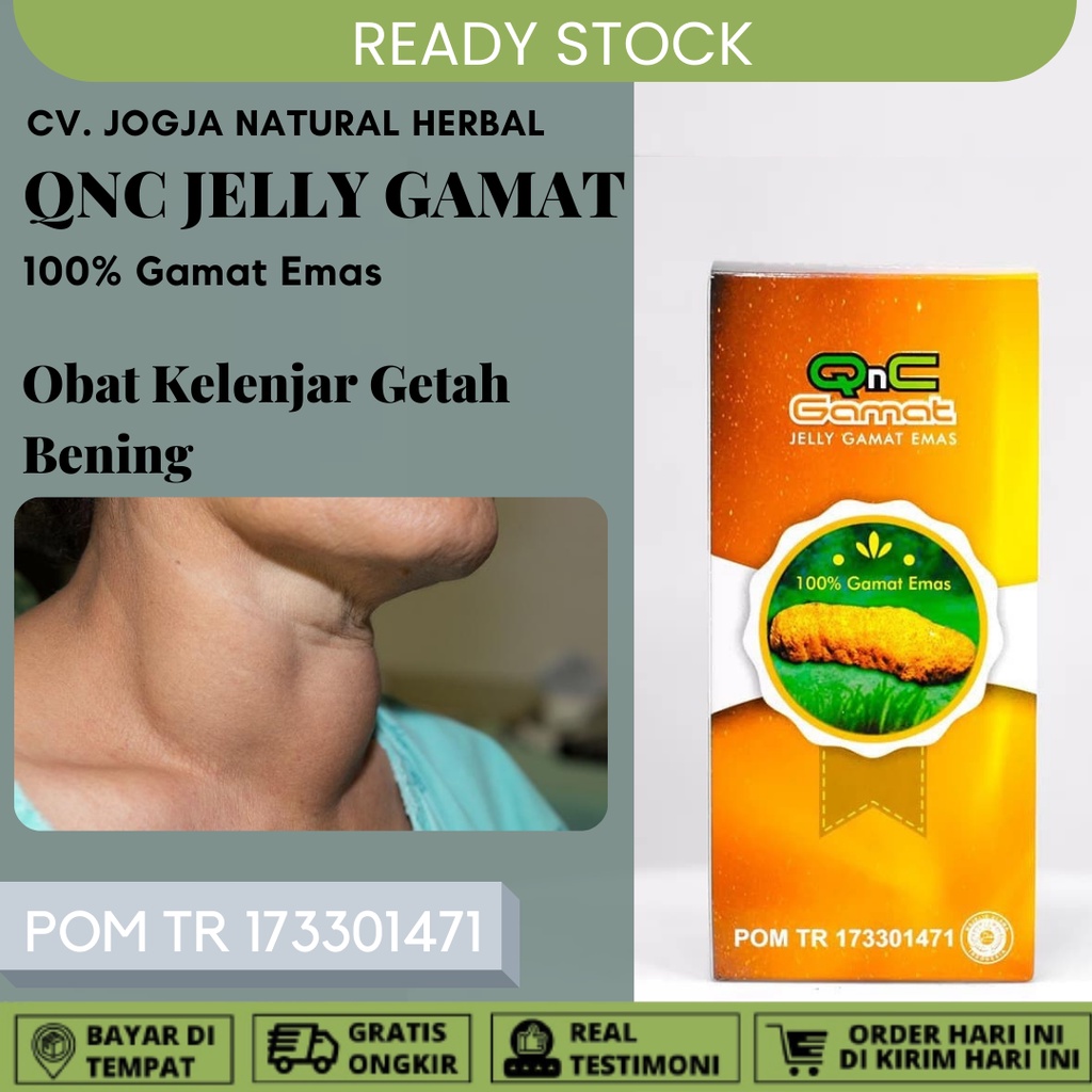 Jual {TERLARIS!!!} Obat Kelenjar Getah Bening Obat Gondok Obat Oles ...