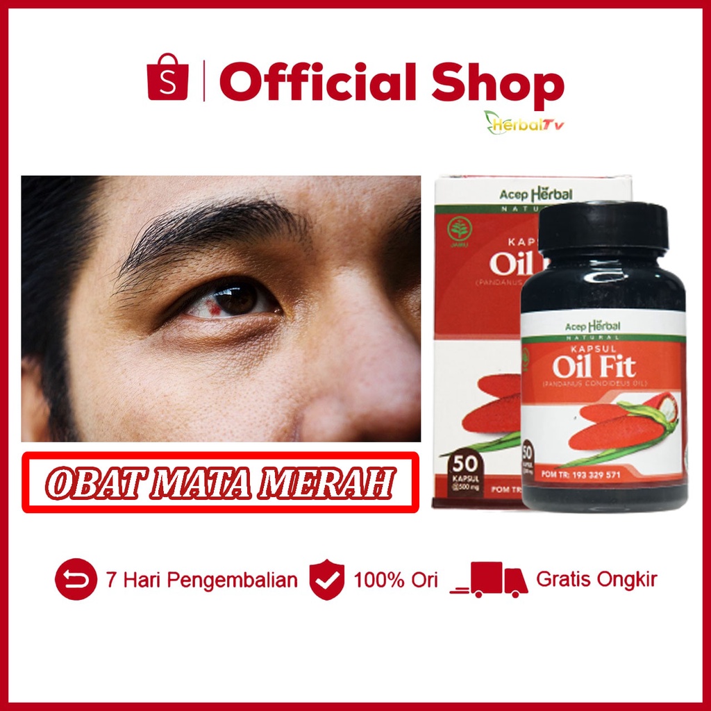 Jual Obat Mata Terkena Las Habis Ngelas Mata Sakit Kena Asap Las