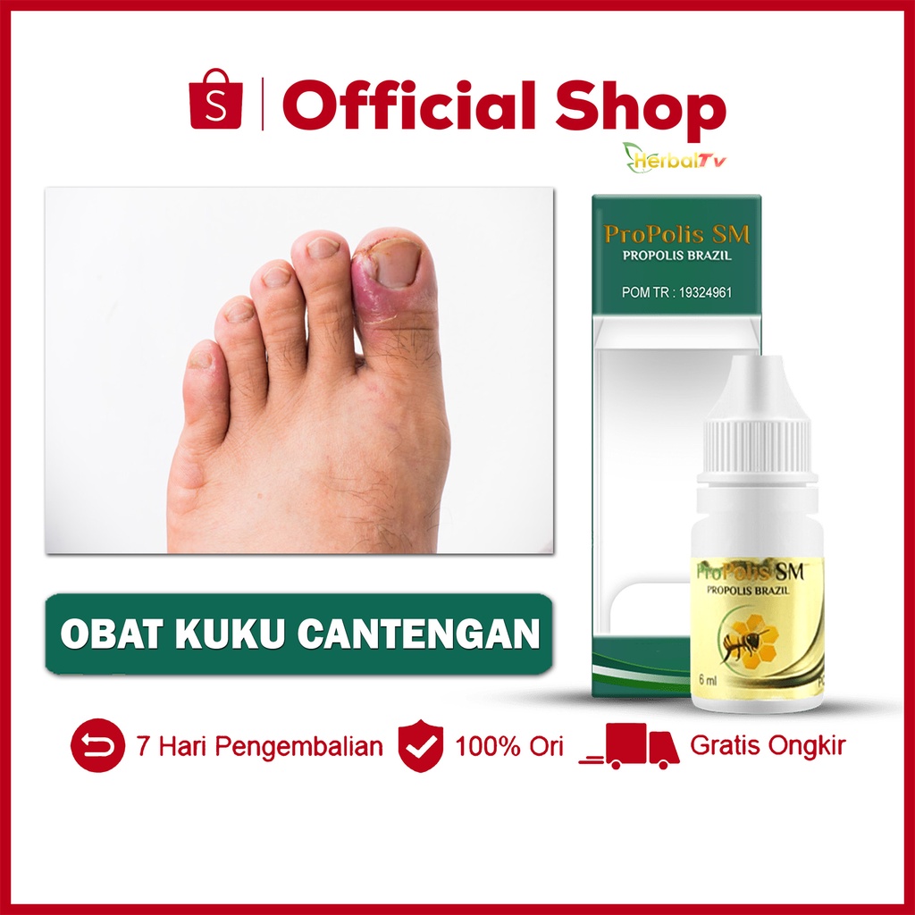 Jual Obat Kuku Cantengan Bengkak Bernanah Kuku Jempol Kaki Bengkak Bau