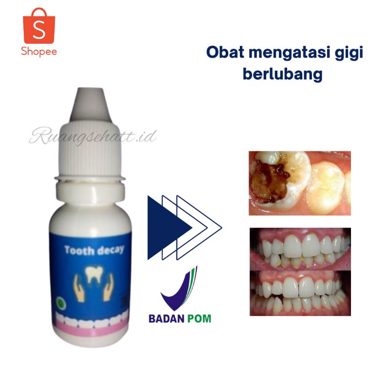 Jual TOOTH DECAY ORIGINAL OBAT PENUMBUH GIGI BERLUBANG GUSI BENGKAK