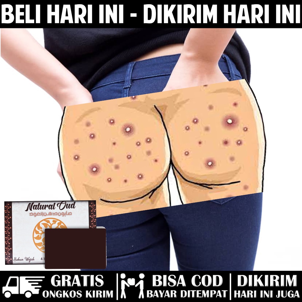 Jual Obat Pantat Bruntusan Pantat Burik Obat Pantat Bruntusan Obat