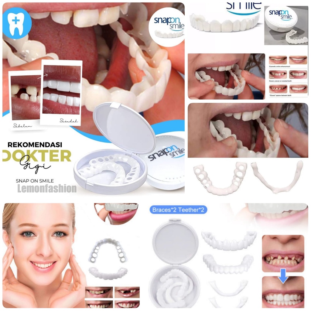 Jual Gigi Palsu Instan Snap On Perfect Smile Satu Set Atas Bawah ...