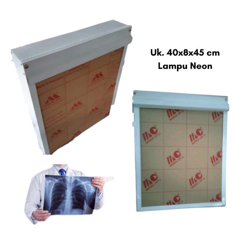 Jual Lampu Baca Foto Rontgen pasien X Ray Film medis single viewer ...