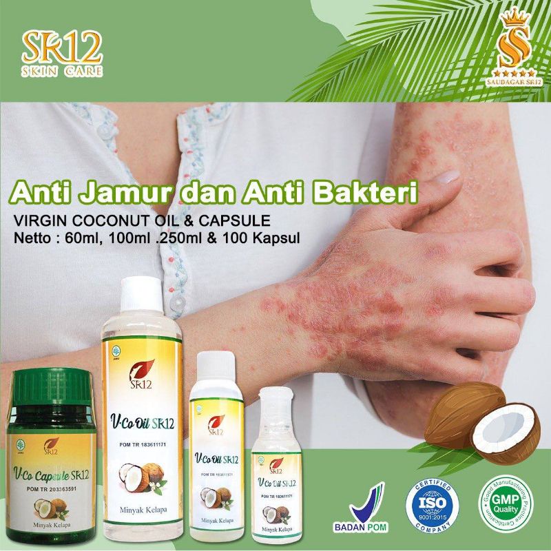 Jual Sr12 Minyak Bayi Obat Gatal Gatal Anti Jamur And Bakteri Minyak