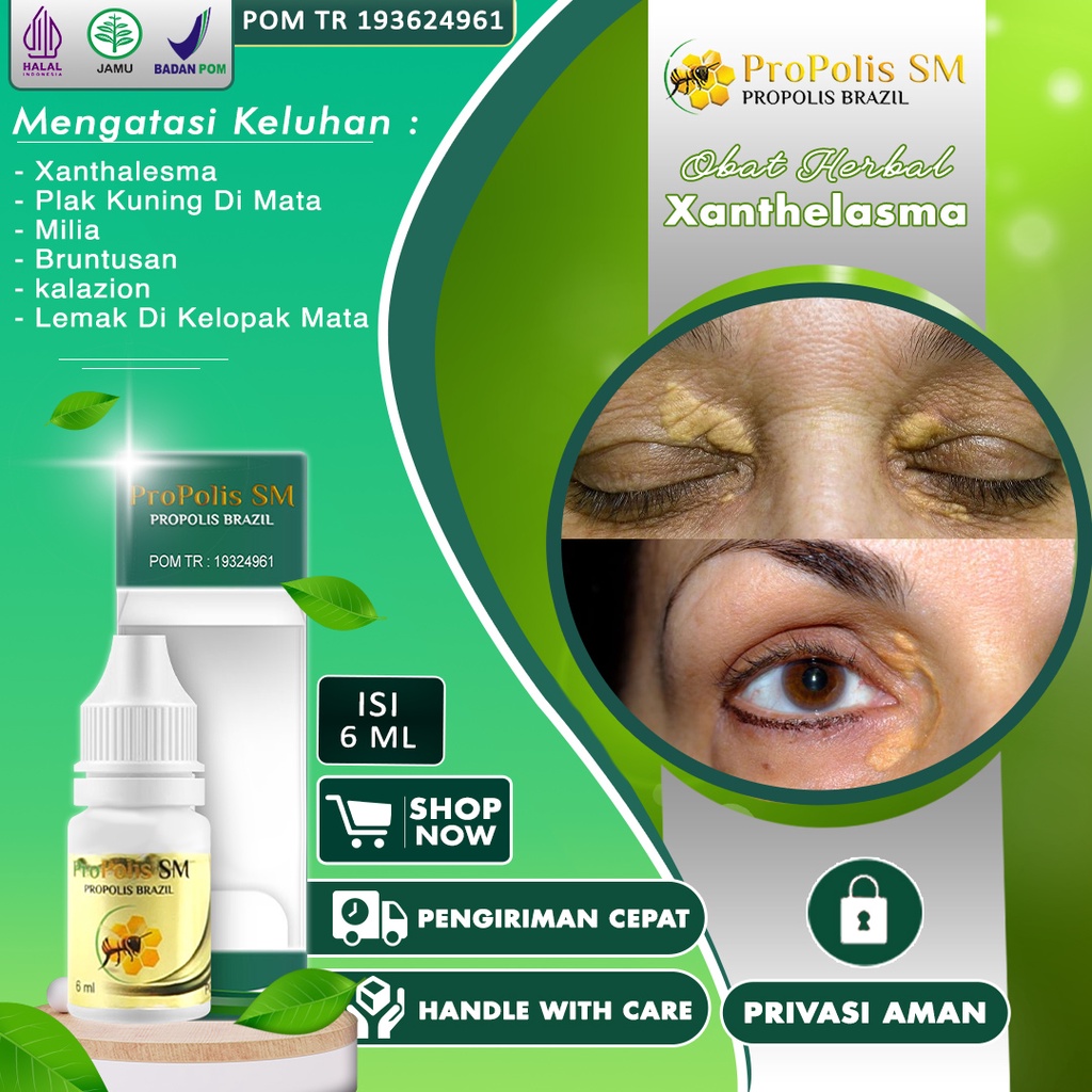 Jual Obat Xanthelasma Gumpalan Lemak Di Kelopak Mata Milia Di Bawah