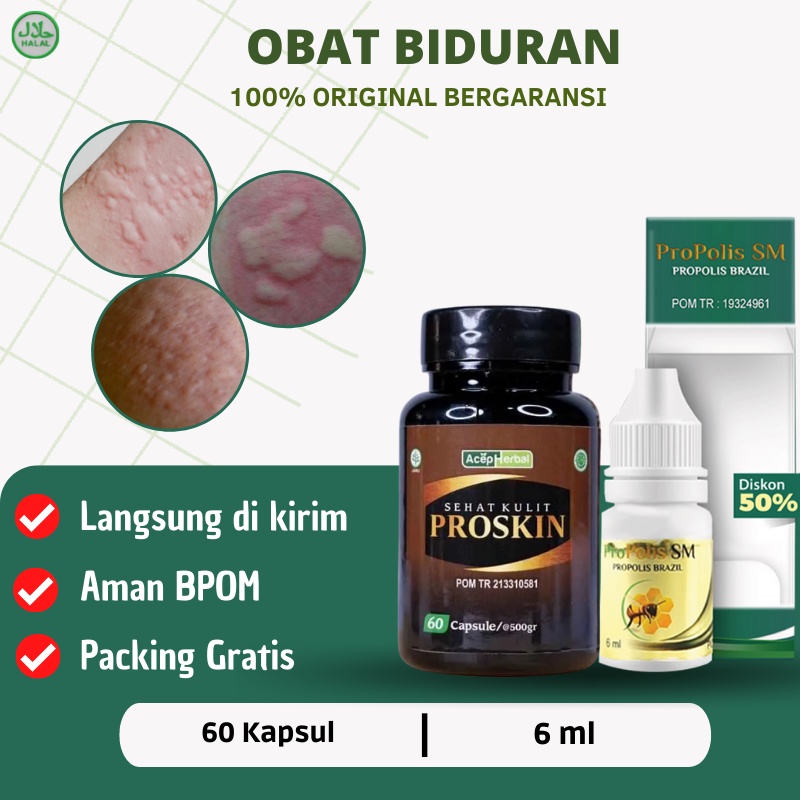 Jual Proskin Obat Biduran Obat Alergi Kulit Salep Alergi Dingin