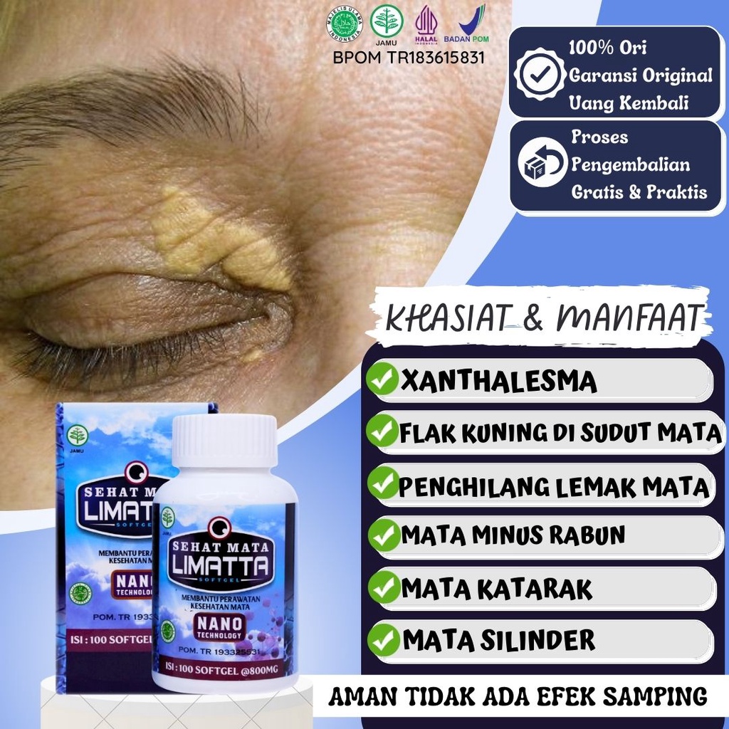 Jual Obat Xanthelasma Penghilang Gumpalan Lemak Di Kelopak Mata Flak ...