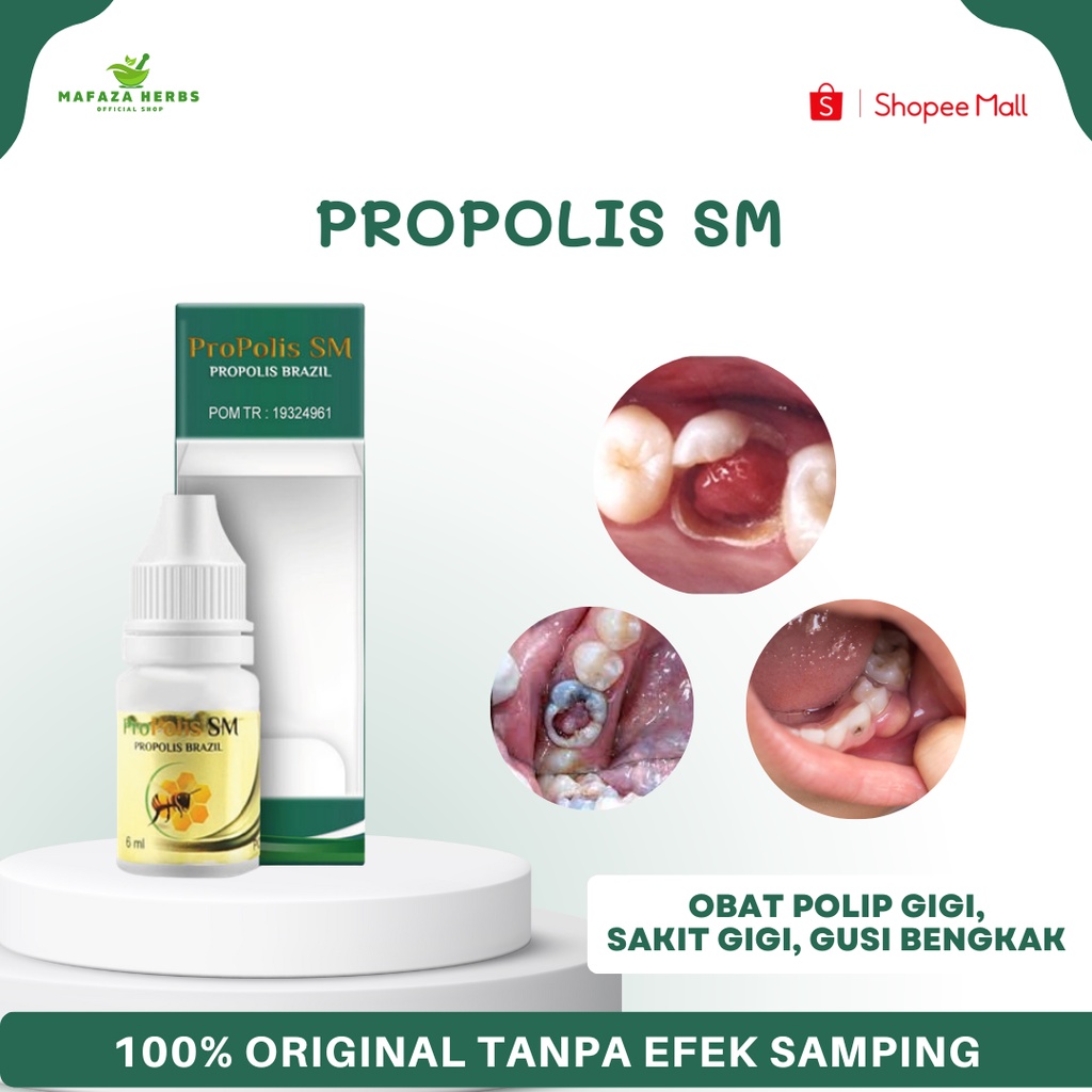 Jual Mafaza Herbs Obat Polip Gigi Obat Polip Pulpa Obat Abses Gigi