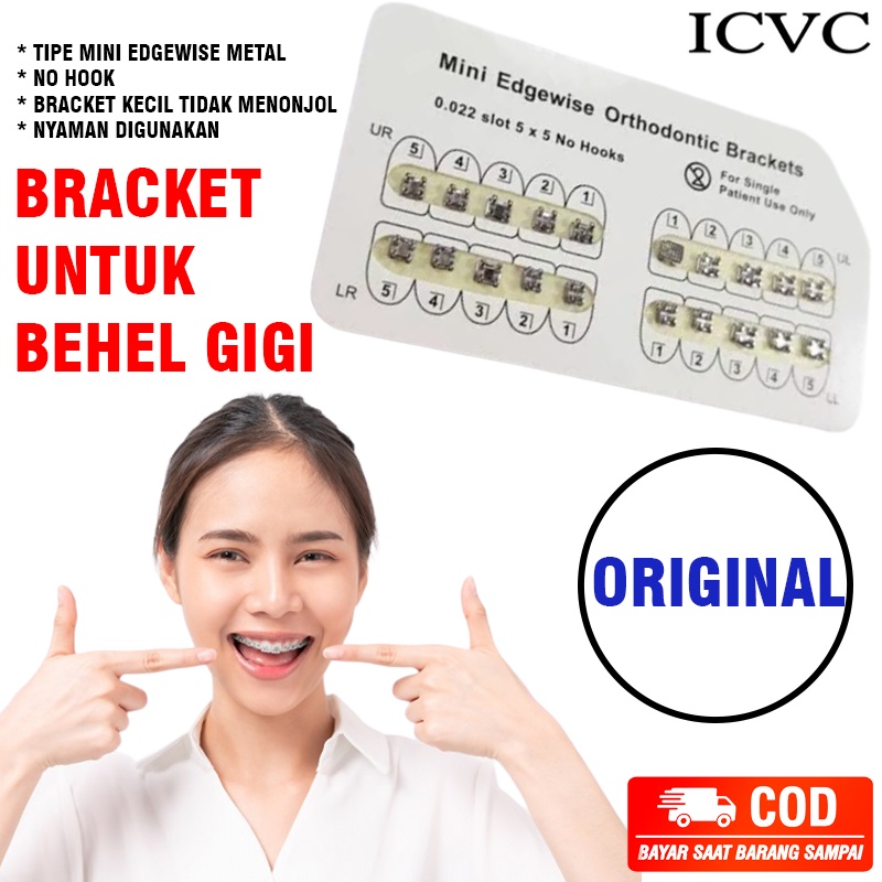 Jual PROMO - 1 Set Komplit Bracket Behel Gigi Atas Bawah -Behel Lepas ...