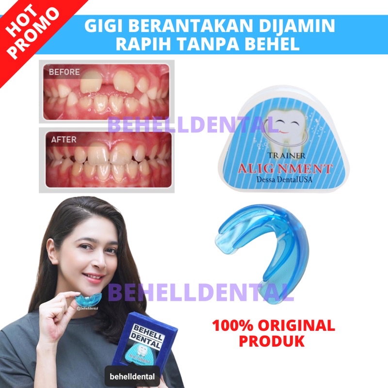 Jual PERAPIH GIGI BEHELLDENTAL ORIGINAL / ALAT PELURUS TANPA BEHEL ...