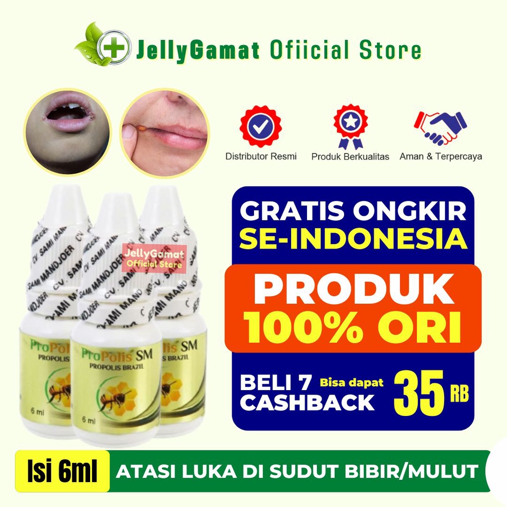 Jual Obat Cheilitis Angular Penghilang Luka Di Sudut Bibir Sariawan Di