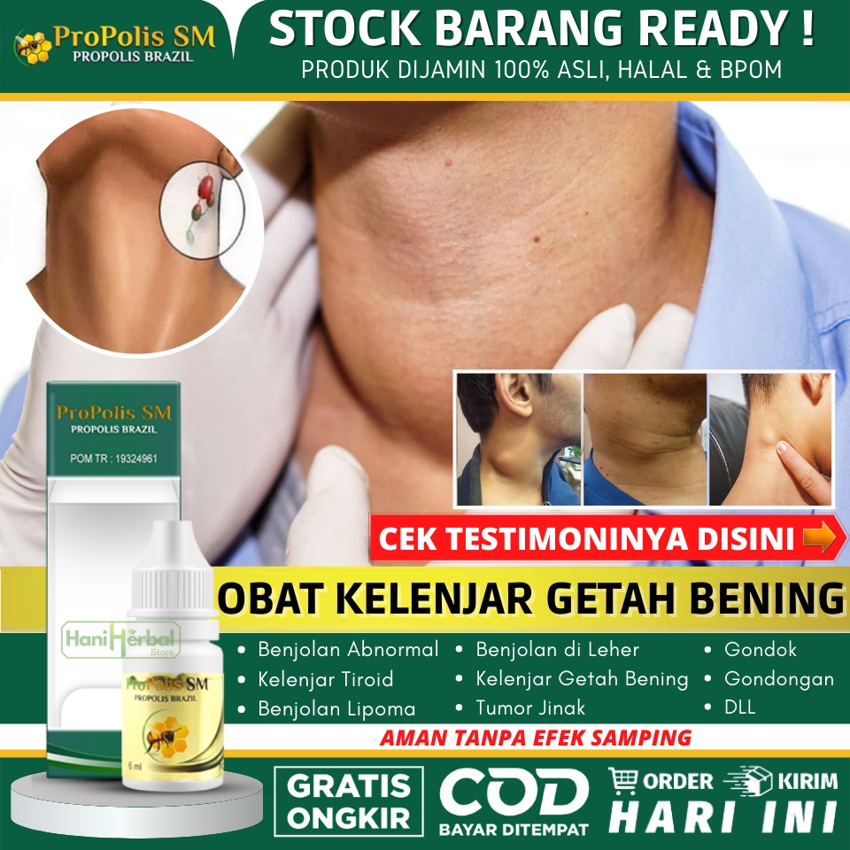 Jual Obat Untuk Menghilangkan Kelenjar Getah Bening - Pembengkakan