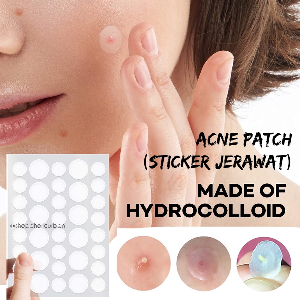 Jual Sticker Penghilang Jerawat Acne Patch Transparan Sticker Pengempes ...