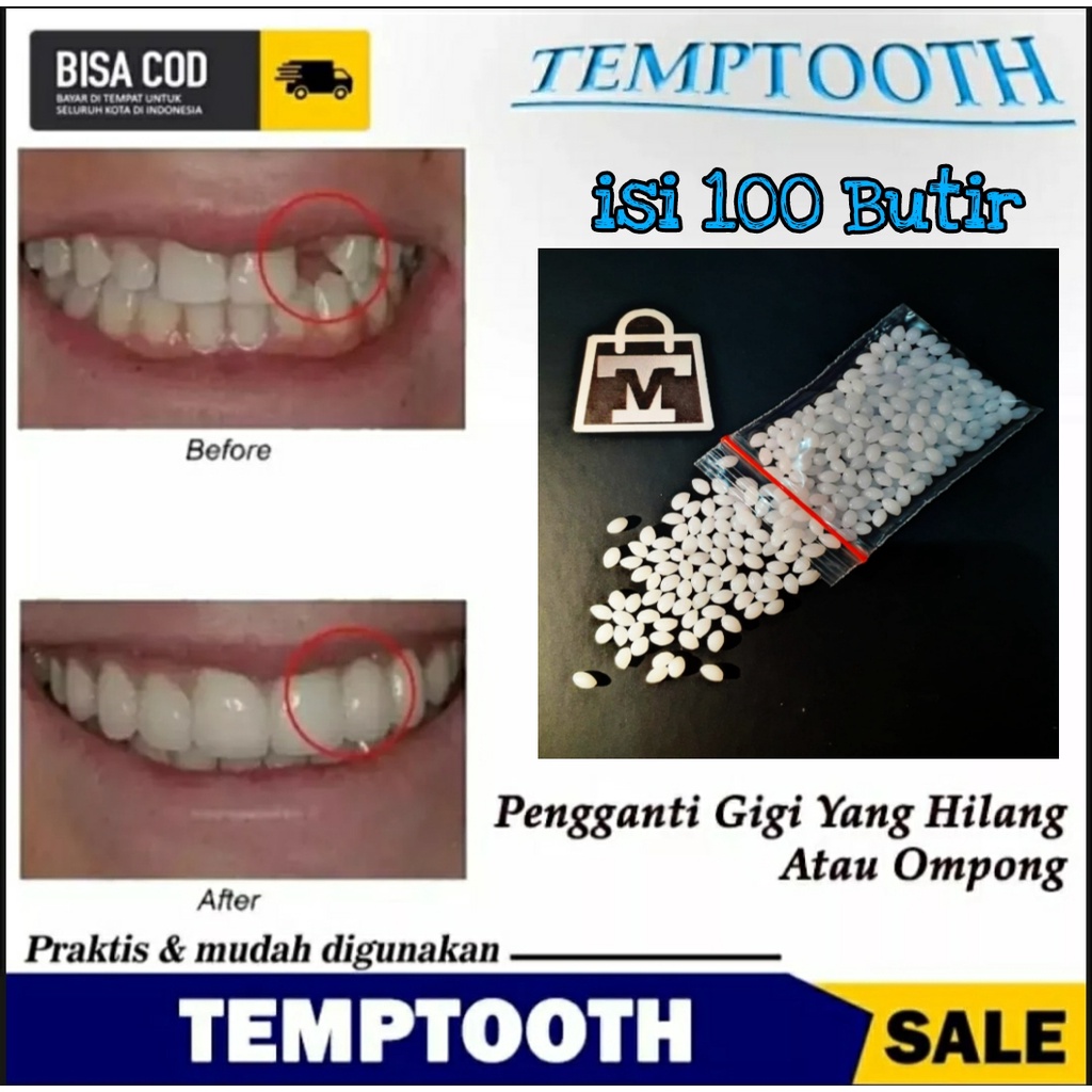 Jual Ready Stock Isi Butir Penambal Gigi Temptooth Tambal Gigi Shopee Indonesia