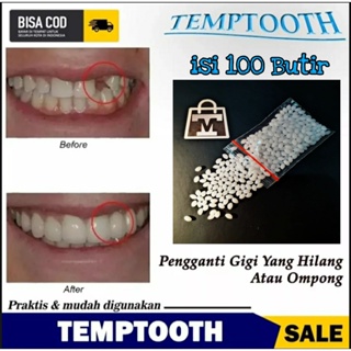 Promo 1000 Butir Temptooth Temp Tooth Lem Gigi Bahan Tambal