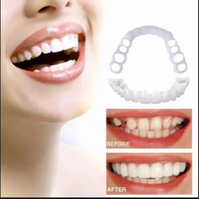 Jual SNAP ON SMILE/GIGI PALSU SILIKON 100%ORIGINAL TRBARU(BISA COD ...