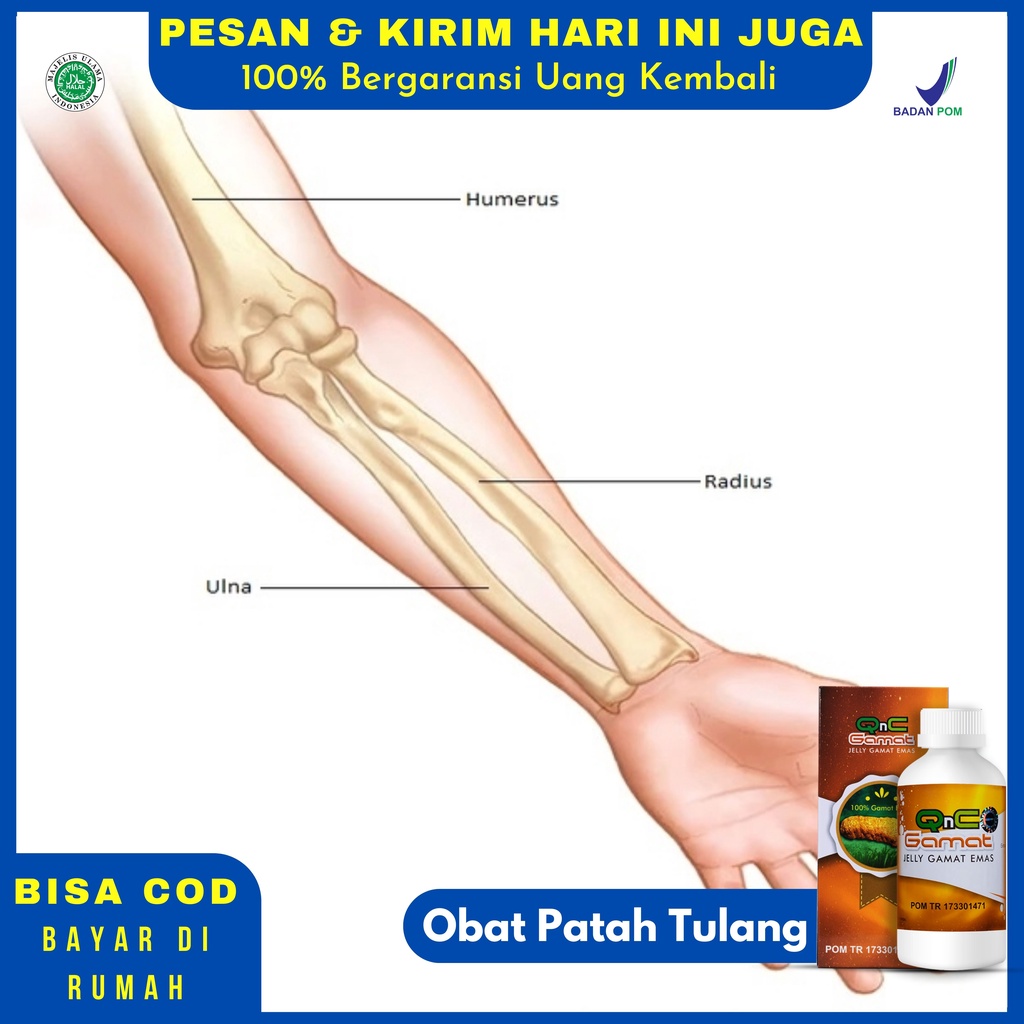Jual Obat Patah Tulang Retak Rapuh Osteoporosis Rakitis Osteomalacia ...