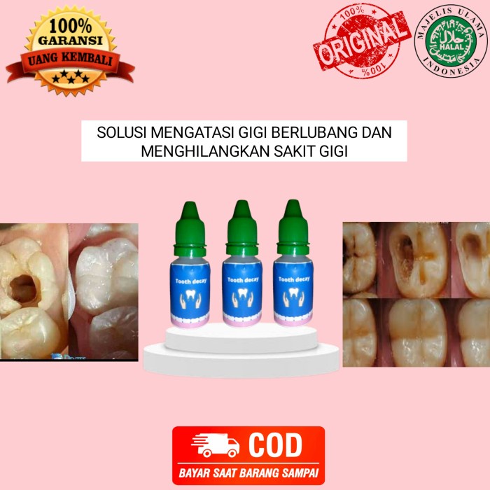Jual White Tooth Decay Ori Penumbuh Gigi Dan Hilang Sakit Gigi (Free