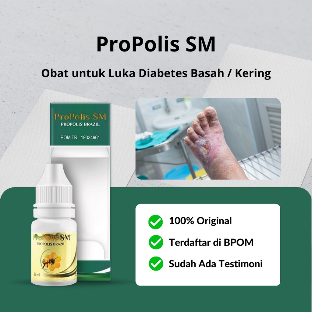 Jual Propolis SM Obat Luka Diabetes Basah Bernanah, Obat Pengering
