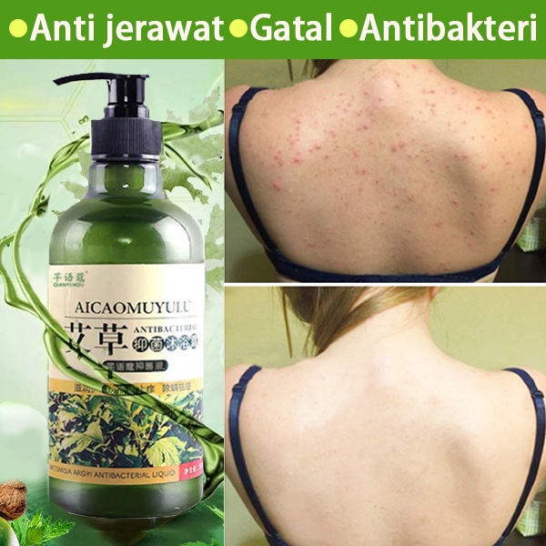 Jual Sabun jerawat punggung ance Body wash whitening sabun jerawat