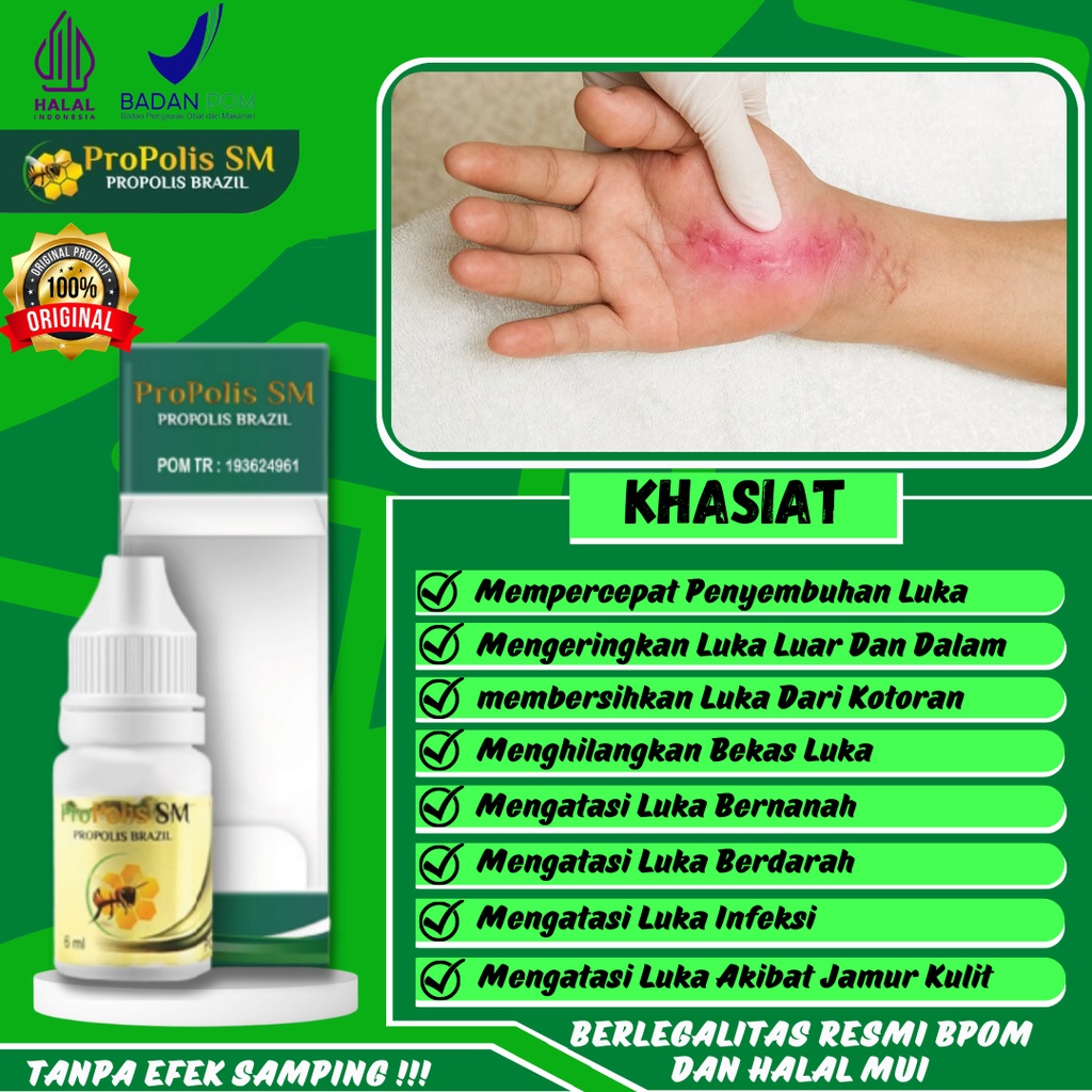 Jual Obat Untuk Obat Penyembuh Luka Obat Pengering Luka Obat Penghilang Bekas Luka Obat Luka 5874