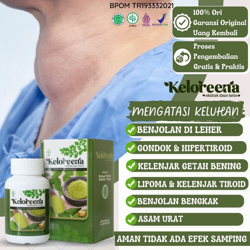 Jual Obat Gondok Benjolan Di Leher Hipertiroid Penghilang Benjolan