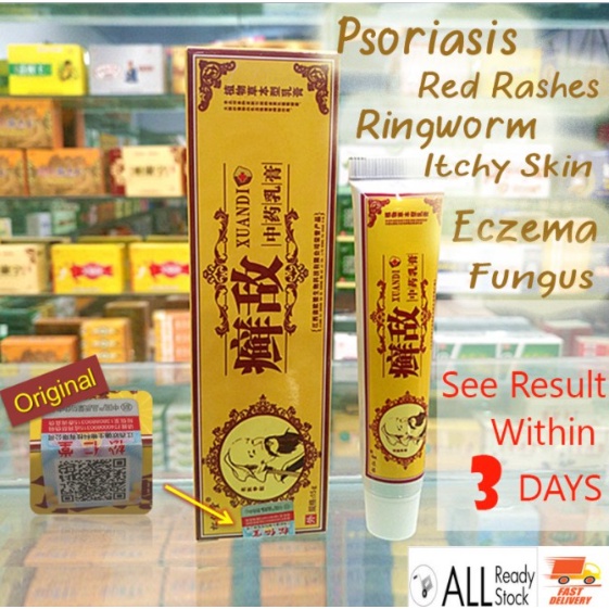 Jual Krim gatal kulit / psoriasis eczema cream / treatment cream