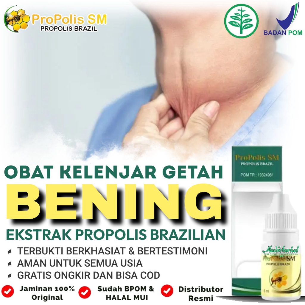 Jual Obat Kelenjar Getah Bening Benjolan Di Leher Pembengkakan Kelenjar