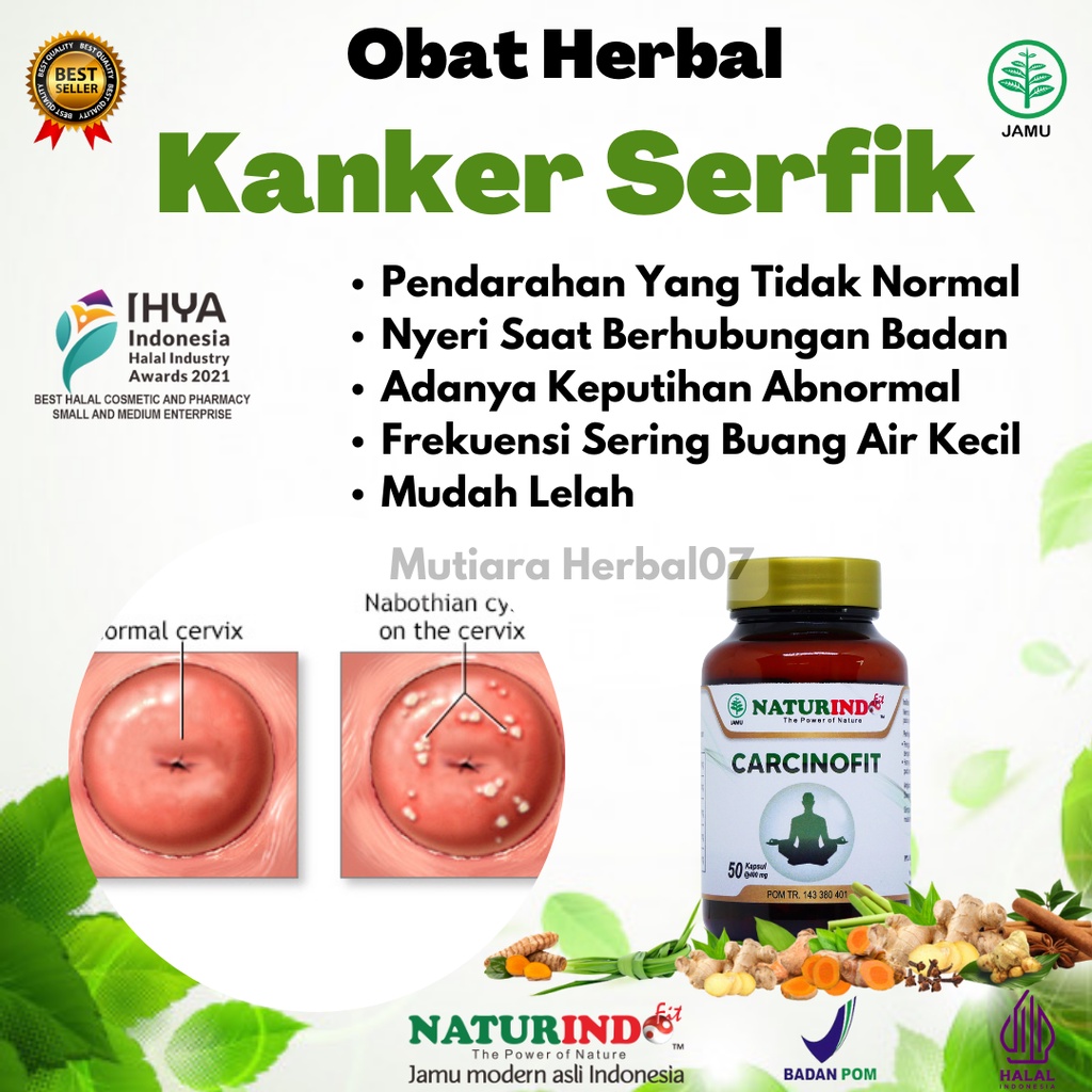 Obat Kanker Servik Serviks Serfiks Rahim Benjolan Vagina Tumor Nyeri Perut Carcinofit Naturindofit