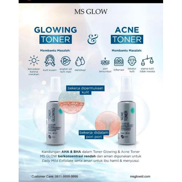 Jual Toner MS GLOW ( glow / acne) Shopee Indonesia