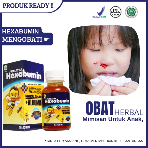 Jual Obat Mimisan Untuk Anak, Demam Dan Mimisan Pada Anak, Hidung Anak