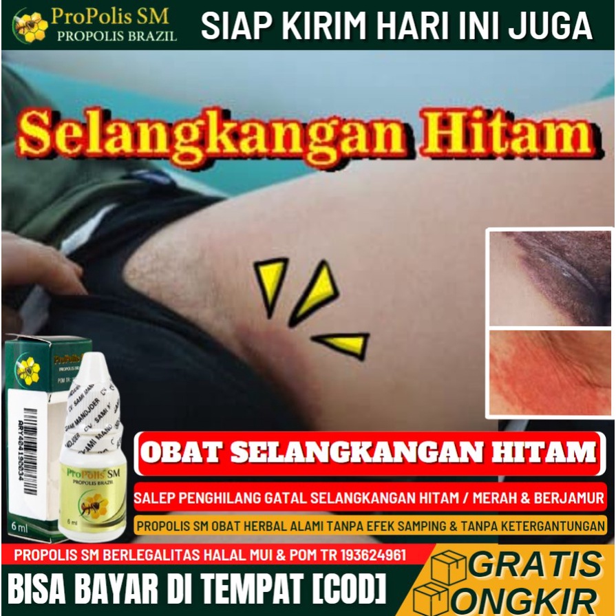 Jual Salep Penghilang Selangkangan Gatal & Berwarna Hitam 100% Alami ...
