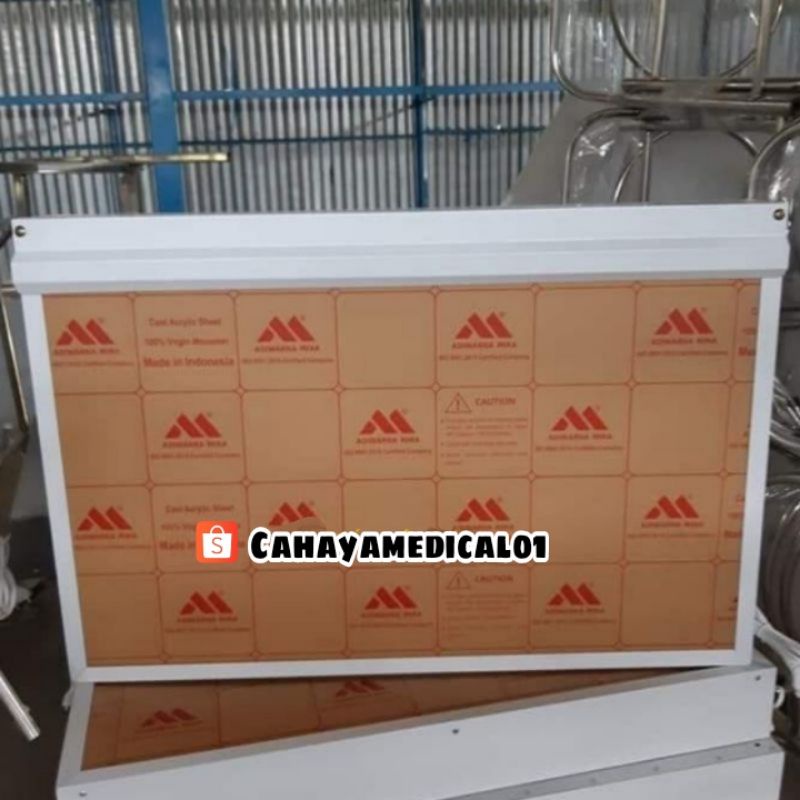 Jual Lampu baca rontgen medis / X ray viewer double / Lampu rongsen ...